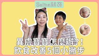 異膚寶寶怎麼辦?訪問雅雯老師改善五個小撇步分享 |Selina開箱