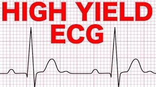 Electrocardiograms (ECG) Made Easy!