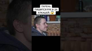 Парень в 16 лет лишился рук..