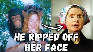 The Shocking True Story of Charla Nash: The Horrifying Chimp Attack That Changed Her Life