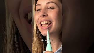 Smile Therapy- Ultrasonic Tooth Cleaner