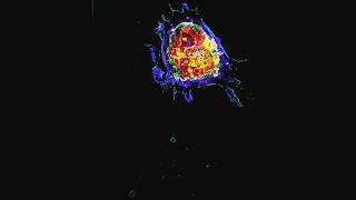 Apoptosis (Programmed Cell Death) - Live and in 3D