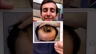 Happy Head Testimonial Video #2
