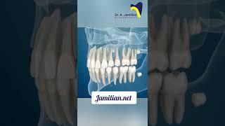 How do permanent teeth replace primary (baby) teeth? #dentist #teeth  #orthodontics #dentition