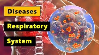 Diseases of the Respiratory System  I  Grade 9 - Q1 l PART 1