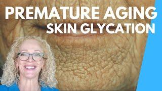 WHY IS MY SKIN AGING SO FAST?  SKIN GLYCATION