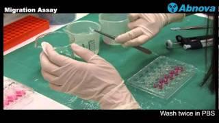 Migration Assay