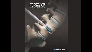Orthofix: FORZA XP Expandable Spacer System