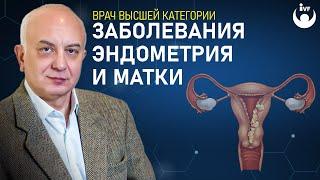 Что такое заболевания эндометрия и матки? Рассказывает врач высшей категории Перелыгин И.В.