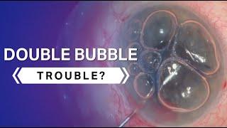 Double Bubble Trouble