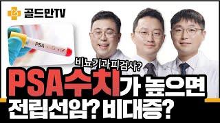 전립선특이항원 PSA검사, 수치가 높으면 전립선암? 전립선비대증?