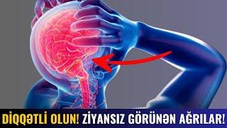 EPİLEPSİYA AĞRILARI - Yaranma Səbəbi Nədir?