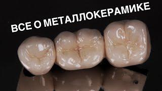 Металлокерамика. Главные минусы. Что такое гирлянда и плечевая масса?