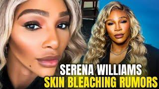 “I’m a Dark Black Woman”: Serena Williams Shuts Down Skin Bleaching Rumors with Grace