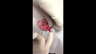 Orbital piercing with heart