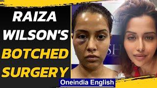 Raiza Wilson face swells after botched procedure | Oneindia News