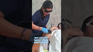 #laserhairremoval #bestlaserclinic #bestlaserclinicdelhi #lasertreatment #dermatologist