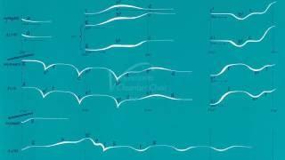 Snowforms - R. Murray Schafer