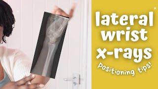 My perfect lateral wrist x-ray technique || Ask The Rad Tech