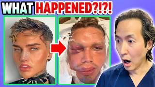 5 Plastic Surgeries on 1 Day That Went HORRIBLY Wrong!