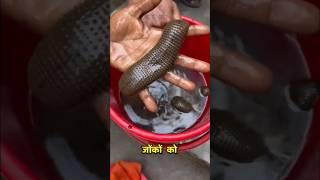 One Hundred Leeches In His Bucket 