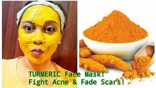 HOME REMEDIES TURMERIC FACE MASK/ BEST ACNE TREATMENT/ GET CLEAR, BRIGHT AND ACNE FREE IN 7 DAYS!