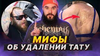 УДАЛЕНИЕ татуировок вызывает РАК? / Главные мифы про сведение тату