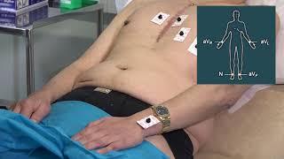 Recording a 12 lead ECG