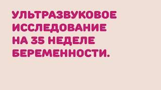 УЗИ на 35 неделе беременности