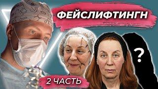 Операция в подарок  На сколько стала моложе по вашему? Доктор СОКОЛОВ А.А. 2 часть.