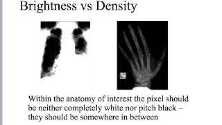 RAD 341 - Image Production - Visible Qualities of the X-ray