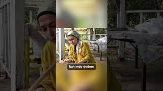 Tıpta En Kanlı Ameliyattır Sezaryen #opdrayseduman