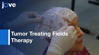 Tumor Treating Fields Therapy Application in Glioblastoma | Protocol Preview