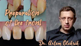 Lesson of preparation of front teeth. Temporary crusts. Dr. Artem Oleksik.