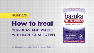 How to treat verrucas and warts with Bazuka Sub-Zero