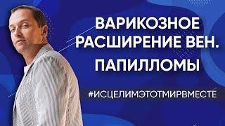 Варикозное расширение вен / Папилломы / Предназначение / Часто болеет ребенок / Финансовые проблемы