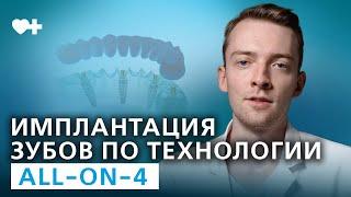 Имплантация зубов методом All-on-4.