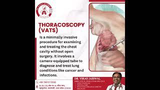 Unlocking Thoracoscopy VATS: Your Guide to Minimally Invasive Surgery!  #pulmonologist
