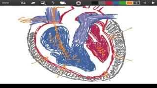 Beck's Triad - Cardiac Tamponade - EMTprep.com