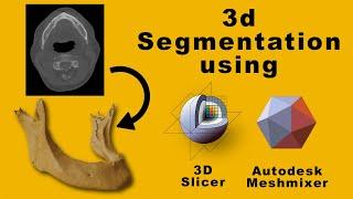 3D Segmentation Workshop - Dicom to STL model using 3D slicer