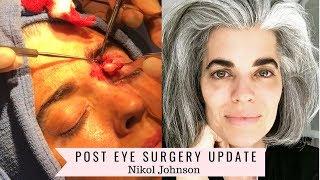 Post Surgery Update | Plastic Surgery | Nikol Johnson