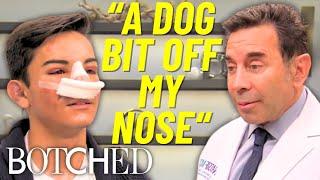 Dr. Nassif Transforms Dog Attack Survivor's Nose With Amazing Results | Botched | E!