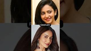 What do you think Rakul Preet Singh underwent any plastic surgeries?