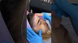 Teen facial waxing forehead-sideburns pink wax @mbrowbar1