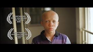 COLOURISM  ( A Short Documentary on Albinism)