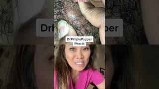 Dr Pimple Popper Needs a SPLASH SCREEN! #DPPReacts