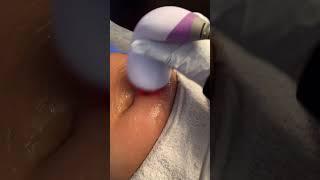The Secret to a Sculpted Abdomen – Cavitation, RF & Laser Pads! | Model: LS-78D2MAXSB