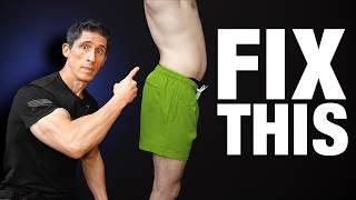 How To Fix Anterior Pelvic Tilt (FOREVER)