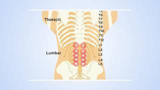 How DRG stimulation at T12 reveals the transmission of low back pain in the spinal cord: The theory