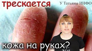 Почему ТРЕСКАЕТСЯ КОЖА НА РУКАХ и как ЛЕГКО от ЭТОГО ИЗБАВИТЬСЯ?